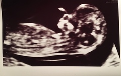 Boy or girl?!