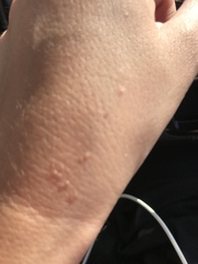 What is this on my hand? Pics