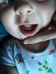 Tooth??