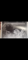 Gender guesses?