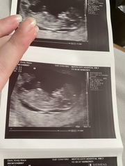 Nub theory boy or girl 💙💕