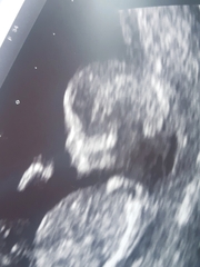13 week scan... any gender guesses?