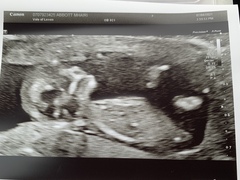 Gender Guesses