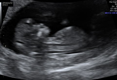 Gender guesses?