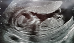 Boy or girl?!