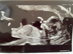 Gender guesses?!