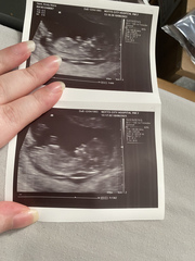Gender guesses I enjoy these💙💕