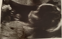 Gender Guesses