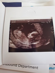 Baby boys scan