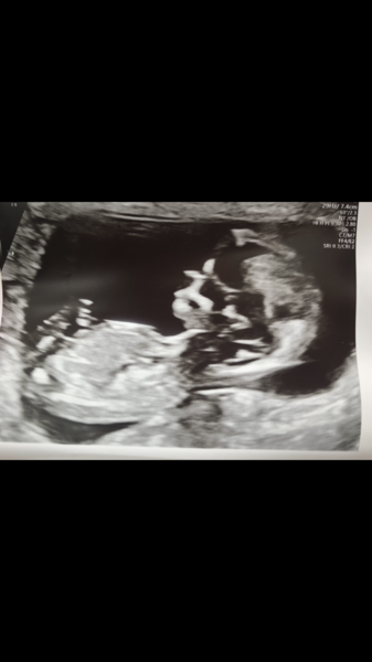 Bit of fun…guess boy or girl