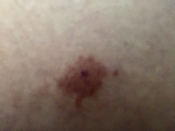 Why do my bites always go like this now?