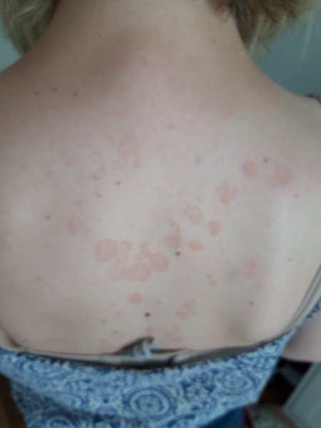 Weird rash