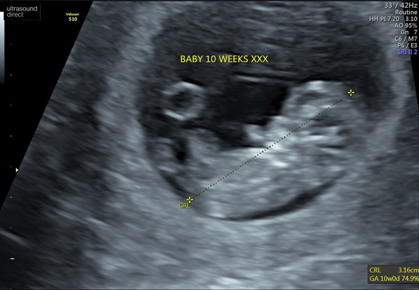 Can anyone guess baby's gender ?