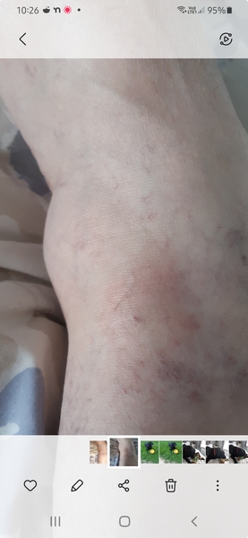 My First Tick!
