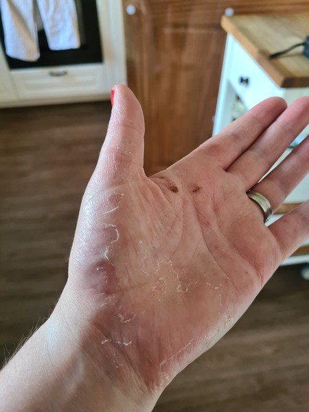 What reason would people be against hand sanitiser?