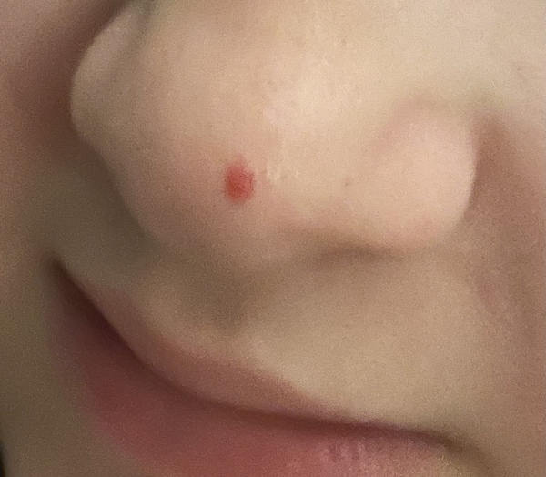 Camouflage makeup? Covering up skin lesion.
