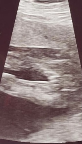 gender scan