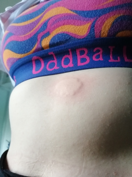 What on earth is this on dd's skin?