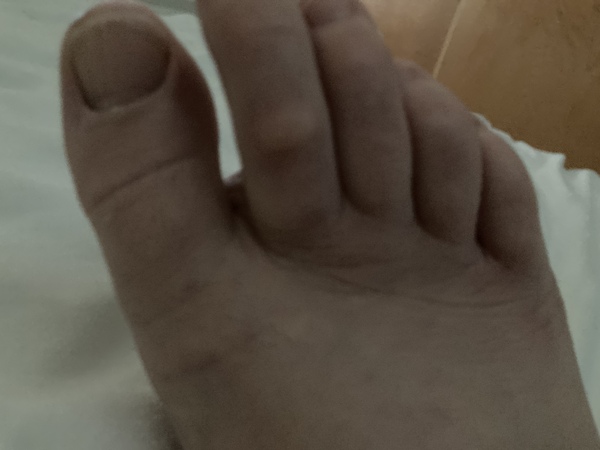 To ask what is this on my toe?