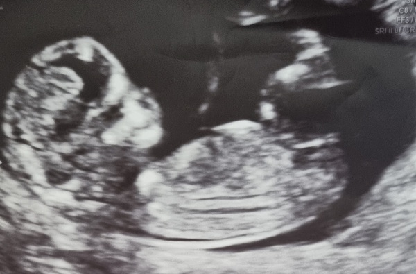 Due February 2022 (thread 2)