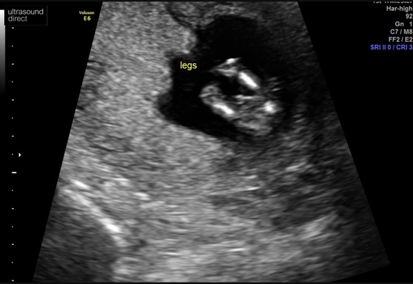 Any gender guesses?