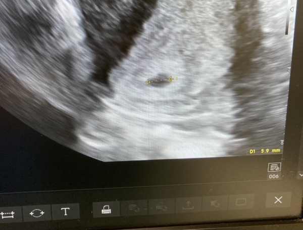 Is this positive?