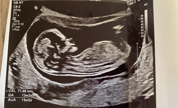 Just got fun, boy or girl?