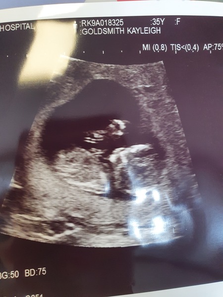 Due February 2022 (thread 2)