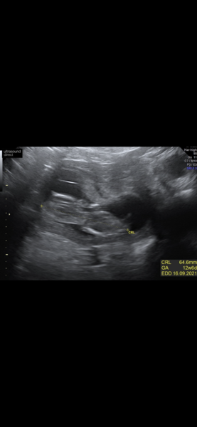 Private Scan- Clinic Recommendations