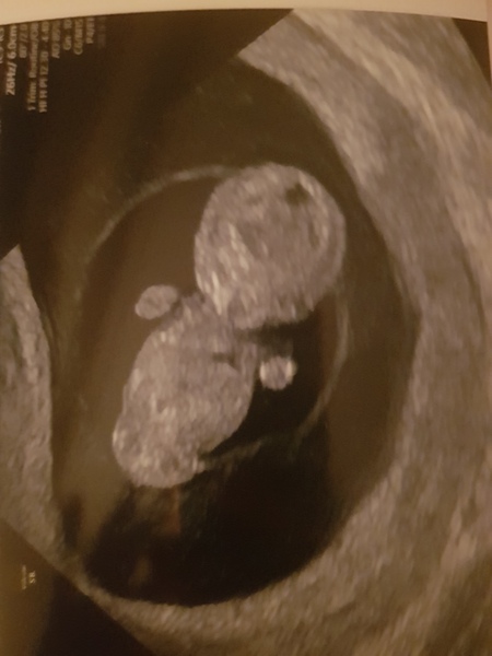 Due February 2022 (thread 2)