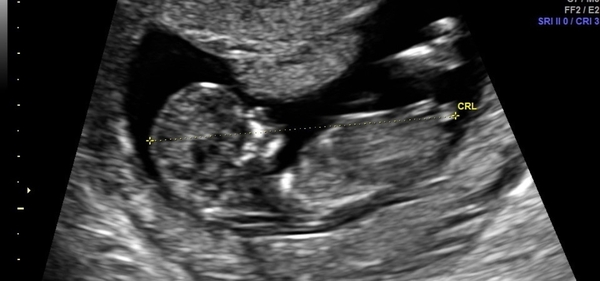 Any gender guesses?
