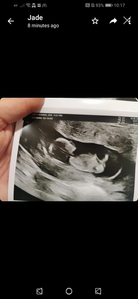 Boy or girl