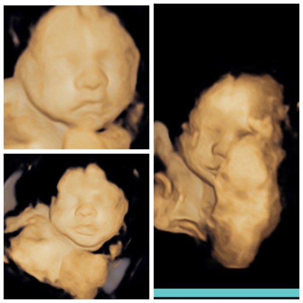 4D Scans….