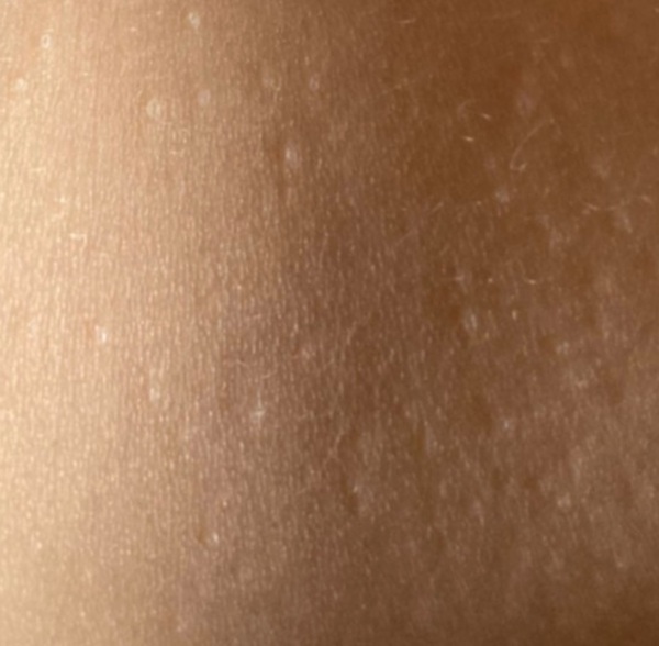 Have you ever seen a rash like this before?