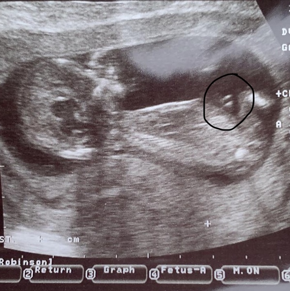 Any 13 week nub theory ideas?