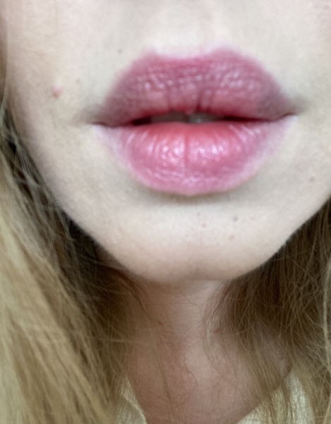 Lips - is this what people are aspiring to these days?