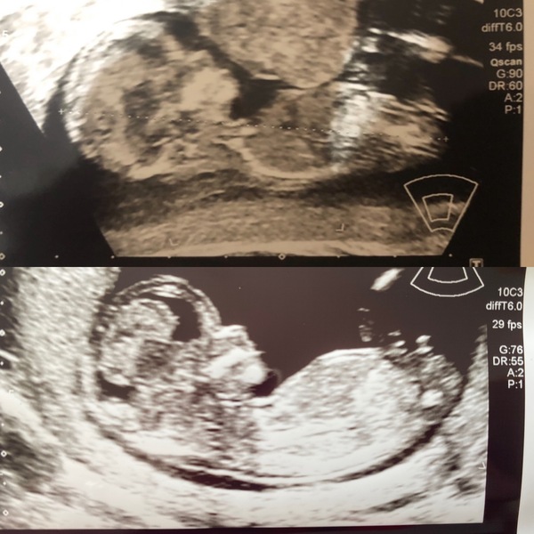 Due February 2022 (thread 2)