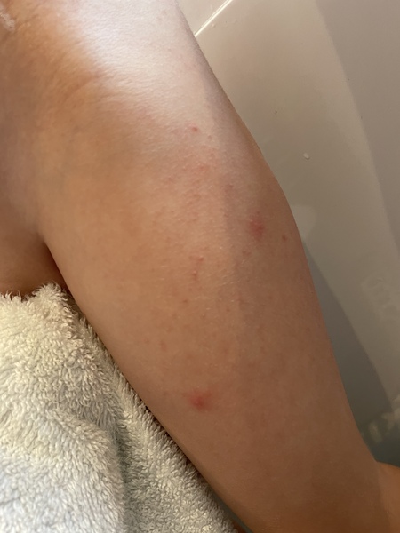 Red spots any idea?