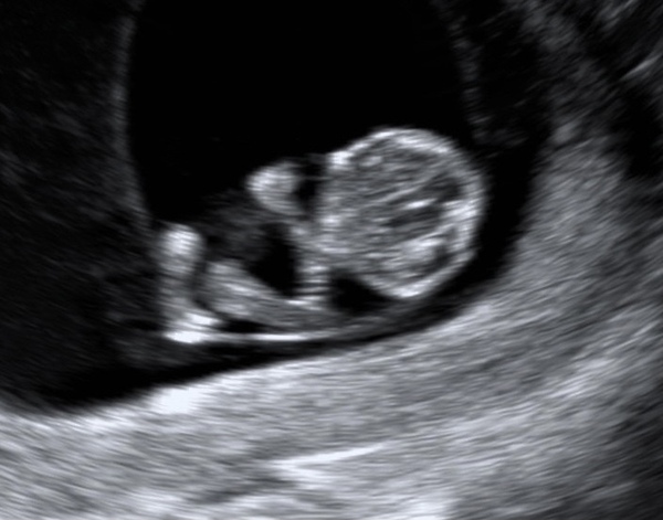 Due February 2022 (thread 2)