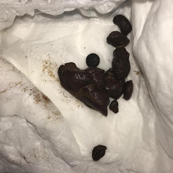 ADVICE PLEASE re 10 month baby with constipation/diarrhoea issues (*warning: contains poo pic)