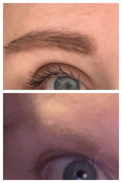 Dd1 has taken chunks out of her eyebrow please reassure me
