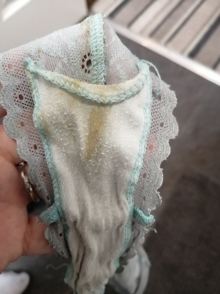Brown blood at 20 weeks pregnant - help!