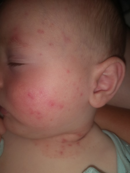 Red spots all over baby's body - any idea on what it might be?