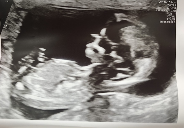 Any gender guesses?