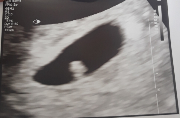 Due March 2022
