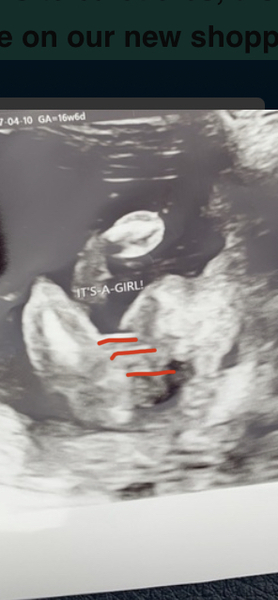 Scan pic girl but I can't see it?