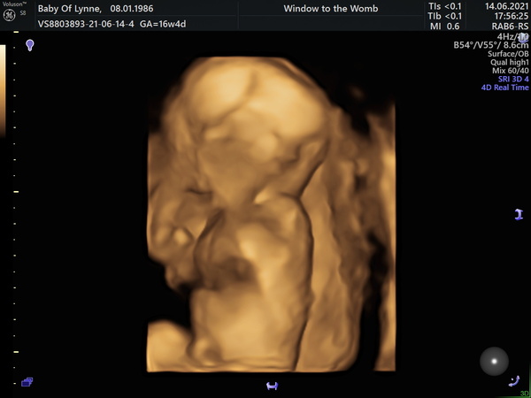 4D Scans….