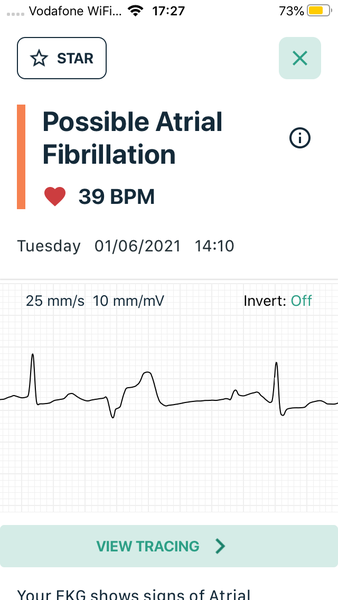 Pfizer Vaccine......DH fitness gone downhill since.....