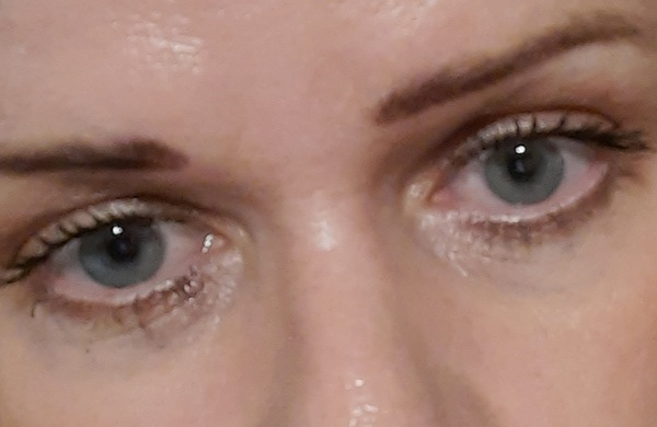 I look so old! What to do about my eyes?