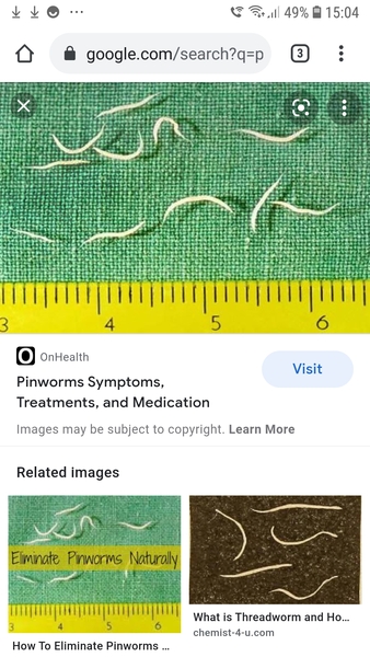 HELP! What kind of Parasite is this?